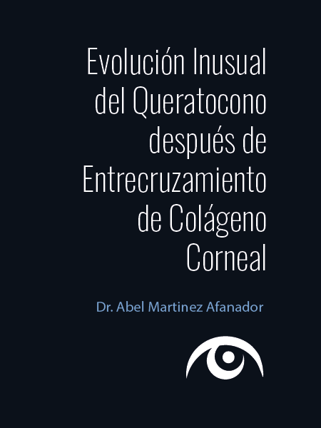 Queratocono: Evolución tras Entrecruzamiento Corneal